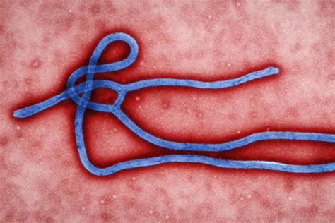 Ebola virus disease .